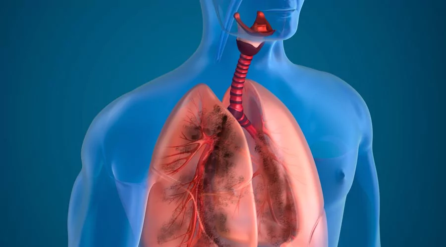 SDNCT realiza recomendaciones para el cuidado de la salud ante humareda