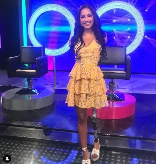 Sin brazos y una pierna joven busca ser coronada como Miss Ecuador
