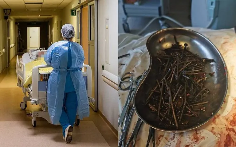 Hombre ingiere 1 kilo de clavos y tornillos como terapia para dejar el alcohol