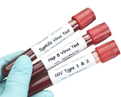 Nuevas prácticas sexuales: ojo con las infecciones