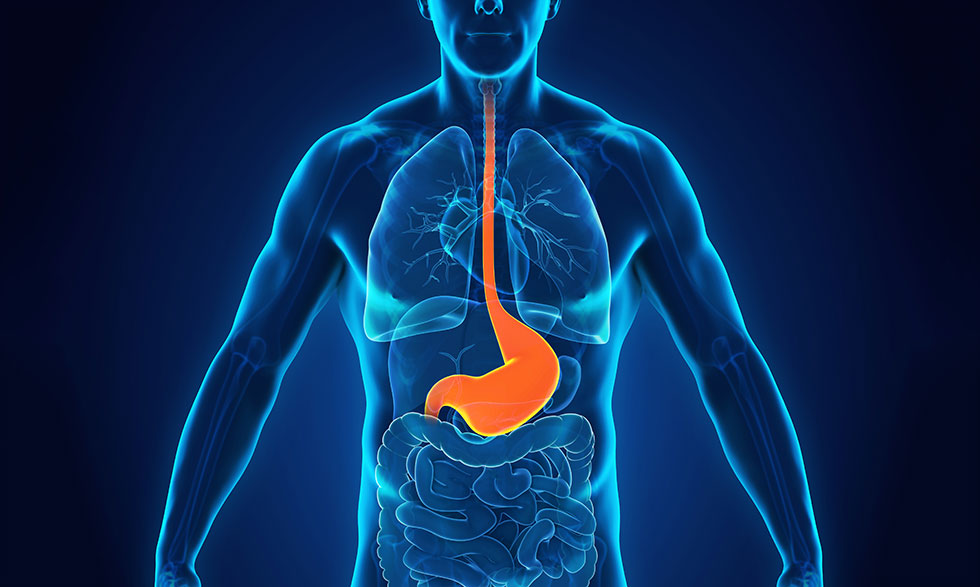 ¿Cuáles son los tres alimentos que más reflujo gástrico generan?