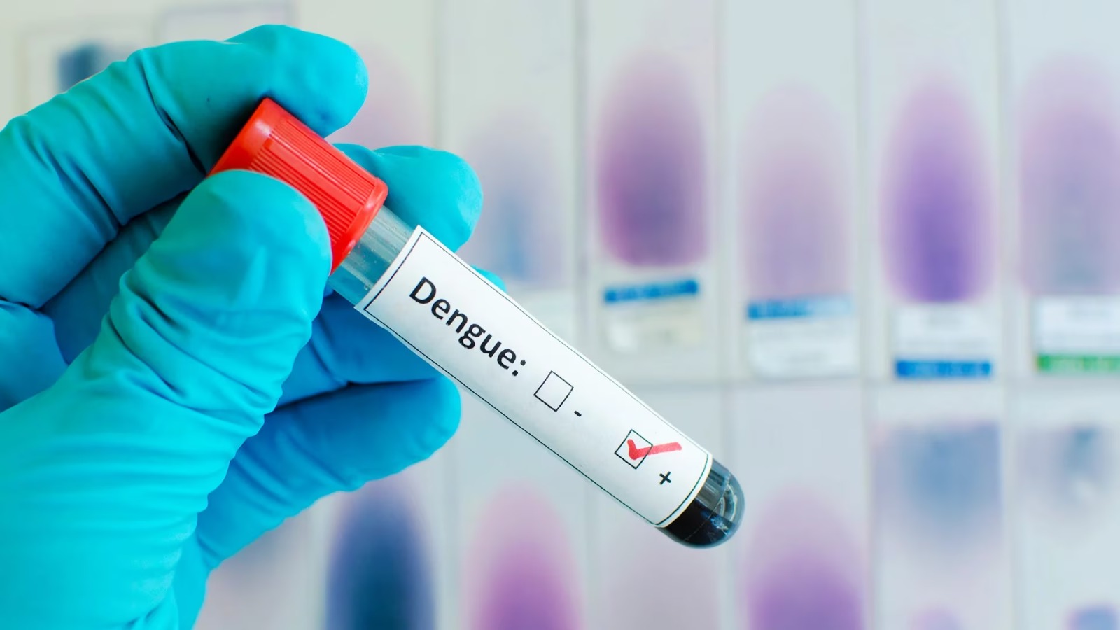Residentes en el GSD dudan de cifras del dengue dadas por MSP