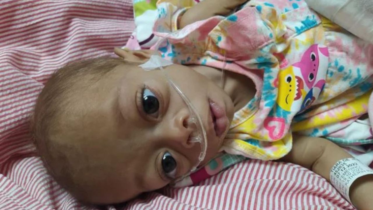 Madre pide ayuda para realizar trasplante de hígado urgente a su bebé