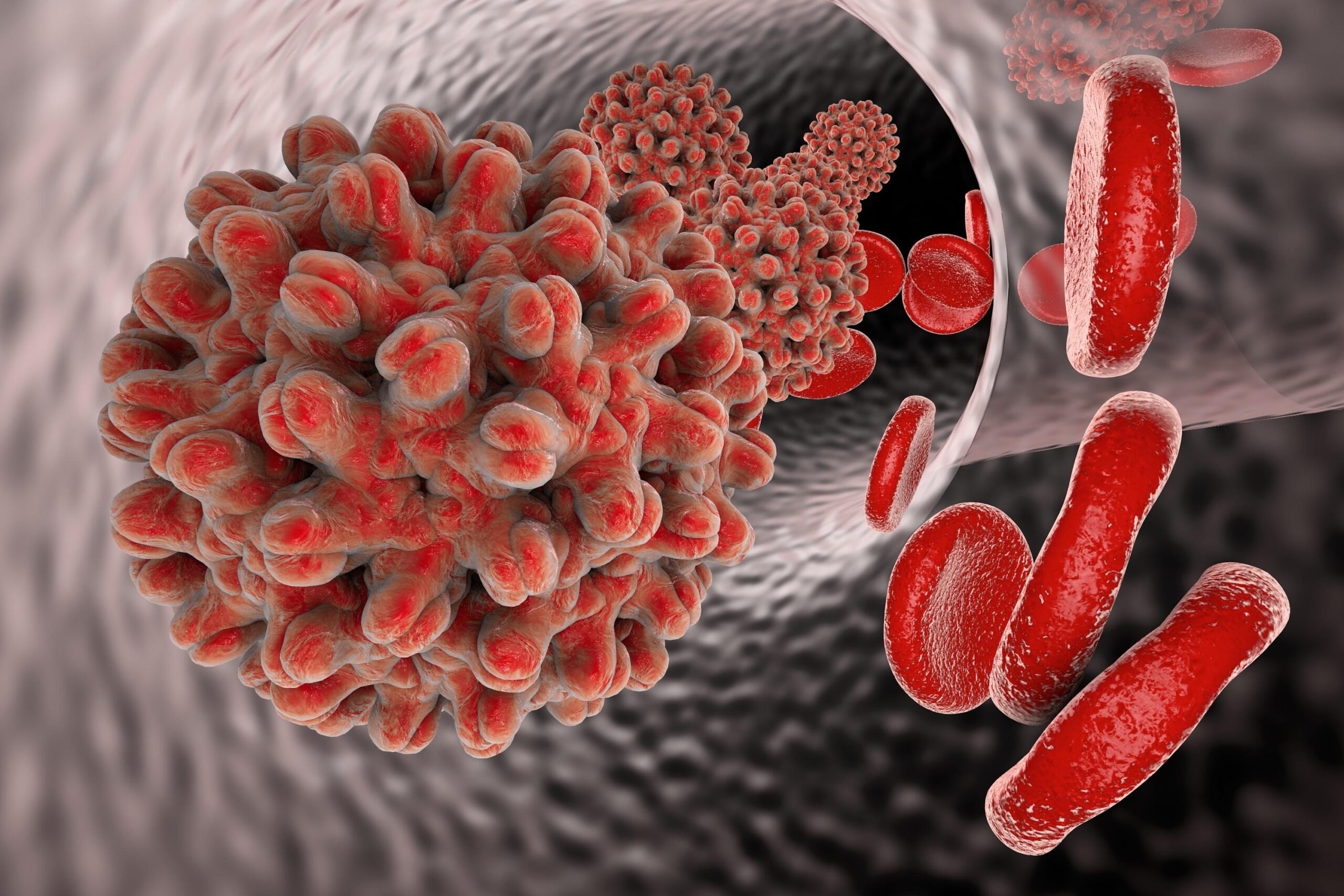 Casos de hepatitis B aumentan en Nueva York, en su mayoría en vecindarios pobres