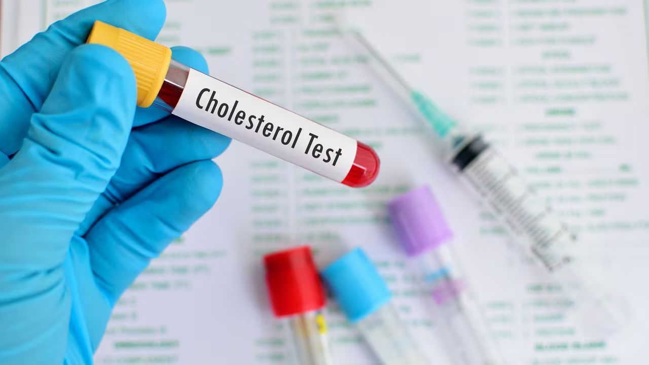 Descubren una vía para potenciar el efecto de los fármacos que reducen el colesterol