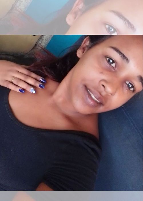 Permanece en estado crítico mujer que pareja le prendió fuego en Los Mameyes