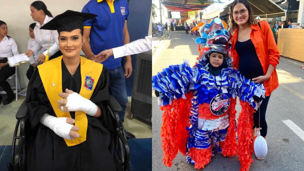 El mismo día de su graduación madre pierde a su hijo por quemaduras en incendio del carnaval de Salcedo
