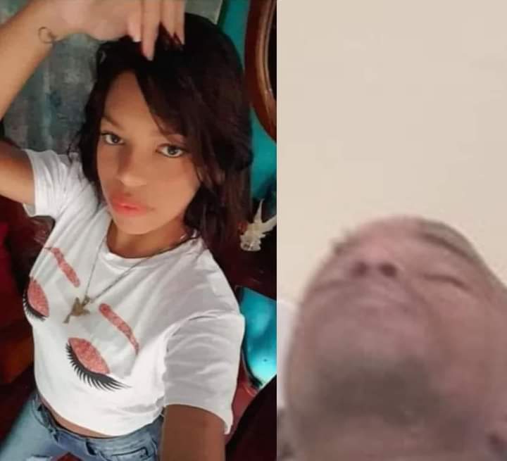 Mujer prende fuego a rostro de su pareja en Los Ríos