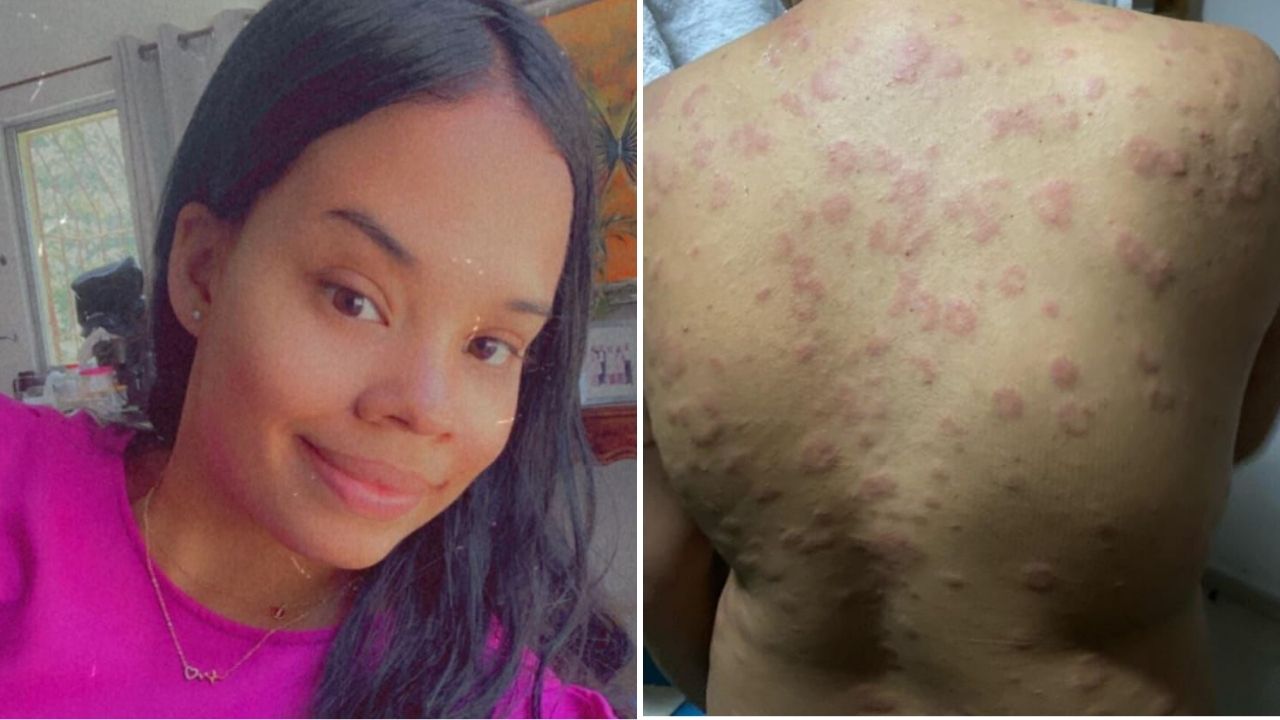 Joven de escasos recursos solicita ayuda para adquirir medicamentos de alto costo