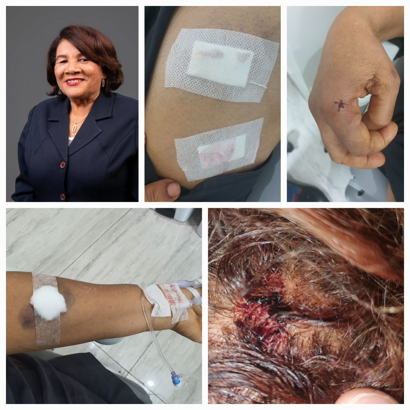 Candidata a diputada Cleo Sánchez fue herida por un extraño dentro de su hogar
