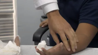 ¡Hito médico! Expertos en microcirugía reimplantan el dedo de un niño