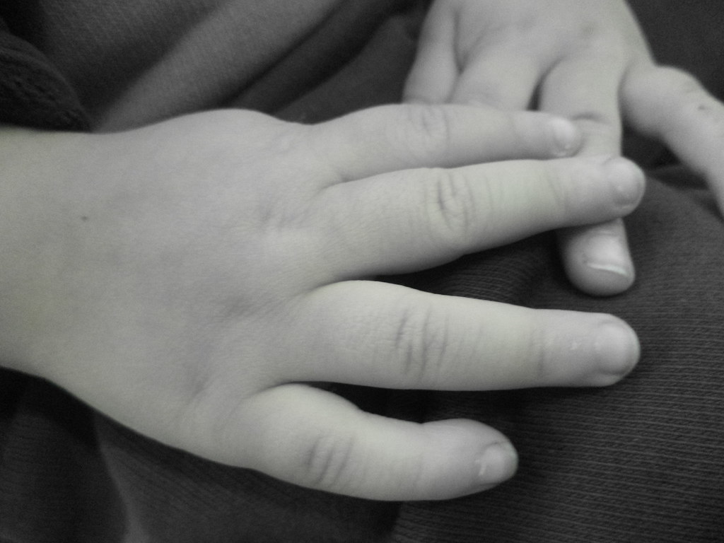 Fallece niña que cayó junto a su madre de un cuarto piso en SDN
