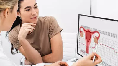 Diagnóstico, tratamiento y seguimiento de miomas uterinos