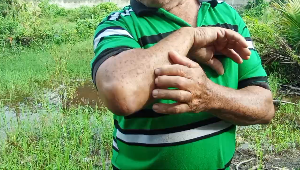 Plaga de mosquitos en Villa Verde; exigen intervención ante temor de brote de enfermedades