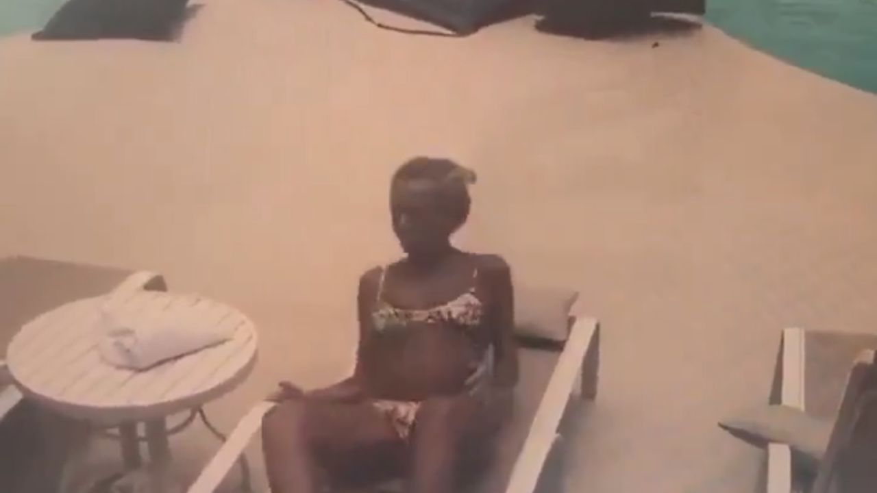 Bala perdida impacta cabeza de mujer  que tomaba el sol en Brasil