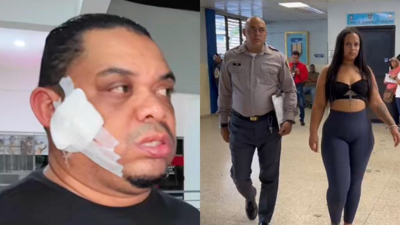 Hieren de una estocada en la cara hombre del vídeo "¿Qué tú quieres, una CRV o un apartamento?"