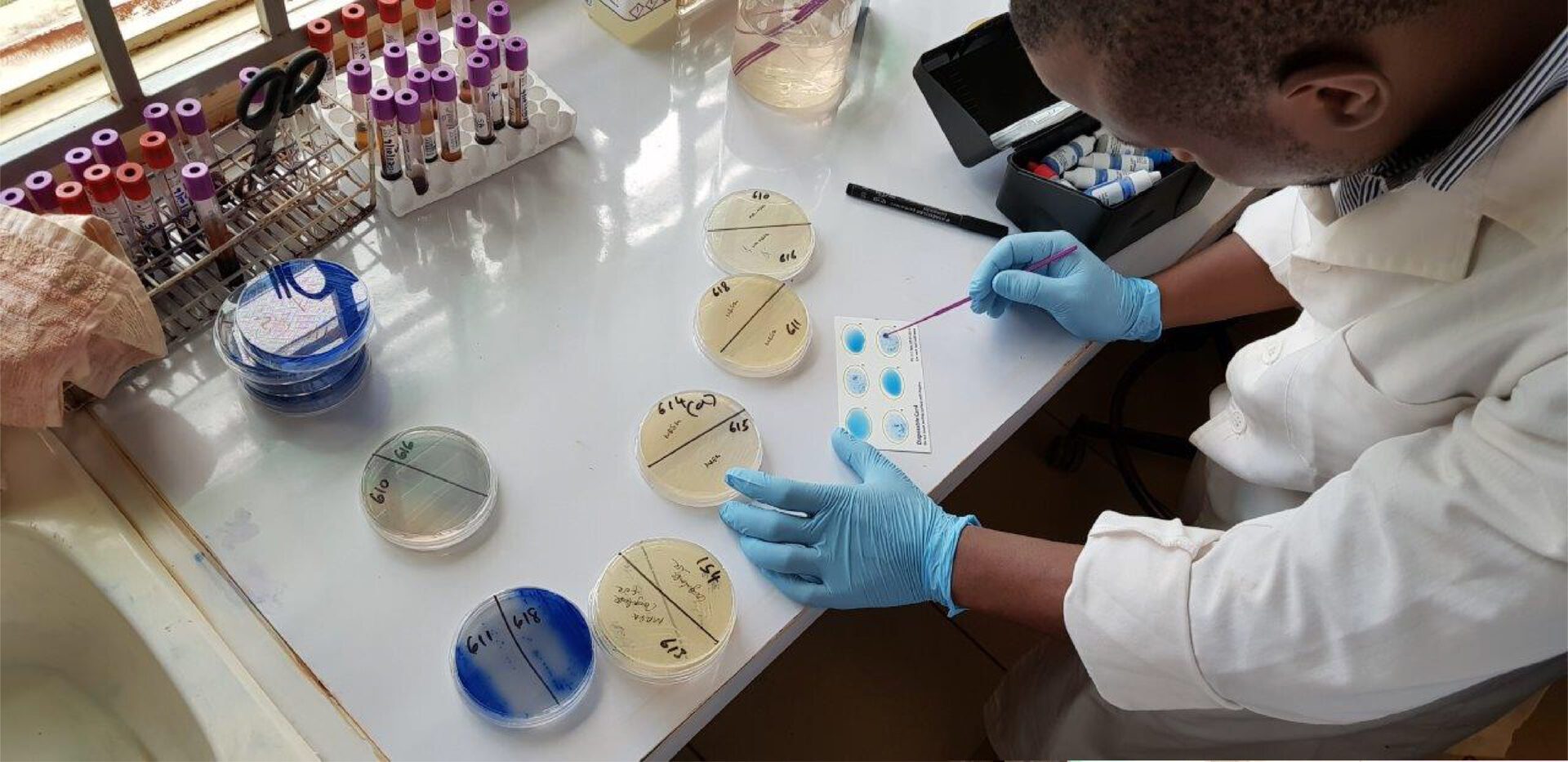 Rusia acusa a EE.UU. de crear una red de laboratorios biológicos en África
