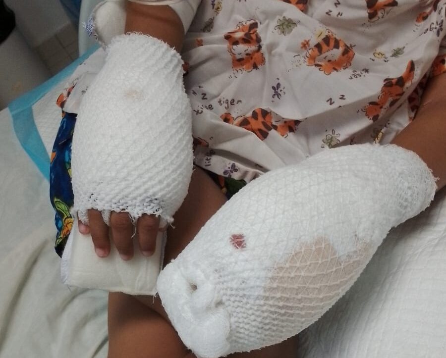 Otra vez aplazan medida de coerción en contra de madre acusada de quemarle las manos a su hijo