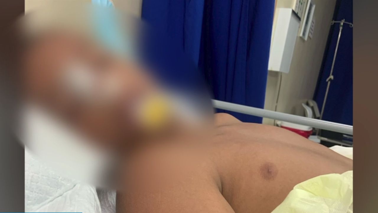 Entre la vida y la muerte se debate menor baleado por delincuentes durante un asalto