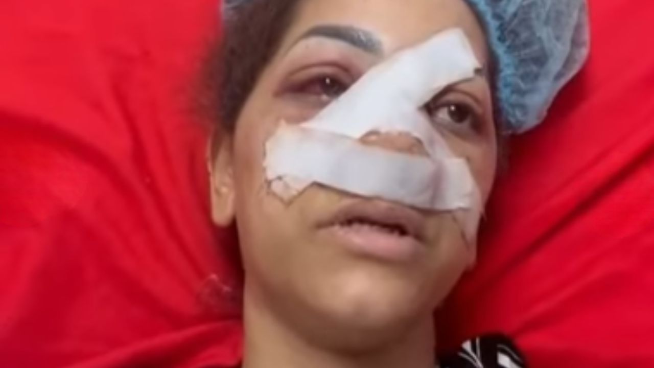 Sobreviviente narra el horror vivido en el Jet Set: "Si Dios me dio una oportunidad, será por un propósito"