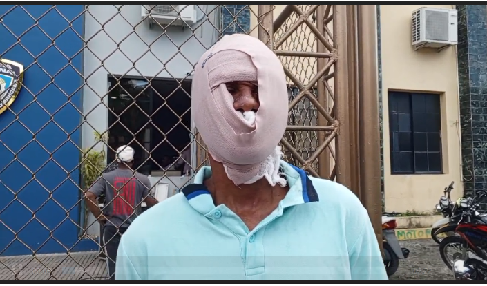 Hombre lanza sancocho caliente a un joven por RD$200 en La Vega
