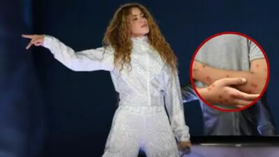 Investigan posible exposición masiva a sarampión en concierto de Shakira en Estados Unidos