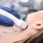 ¿Tiene hipotiroidismo? Experto explica el diagnóstico y lo qué significa