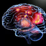 La epilepsia trastorno convulsivo cerebral