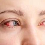 ¿Te arden los ojos? El polvo del Sahara y el calor podrían ser los culpables