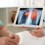 Cáncer de pulmón muestra sus garras en RD y 52% casos se detecta tarde