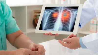 Cáncer de pulmón muestra sus garras en RD y 52% casos se detecta tarde